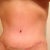 TT 1/31, finally very little swelling!