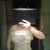 4 days post op, i didnt wanna take off the bandages