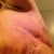 Lipo Ouchies