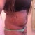 Pre op 4/7/12