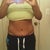 week 4 post op
