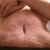 I'm 19 days PO today. swelling or not enough taken out? this pic was from this morning