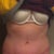 4 months PO. (Sorry for TMI, but my lower belly is bloated from PMS)
