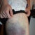 Bruising Day 2
