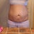 before surgery after my 2nd child though not my 3rd.