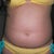 Pre-op belly close up.  Not the crease to differentiate my top and bottom belly.