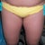 Pre-op flabby inner thighs.