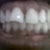 Pre-treatment