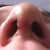 Nostrils still uneven due to swelling, but looking a bit better every day! :)
