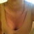 1 week post op