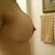 side view: almost 2 months post op! ?