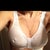 One wk post op! See the boobie on the right that's the one I'm having pain! Hematoma blood clot! Infection!