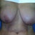 Pre- op