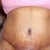6 week front view, wish I could get rid of the stretch marks