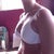 7 days post op.