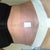 3 days post op - morning