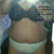 pre-op June 2012