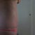 4 months po