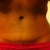 6 month PO scar