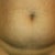 Preop photos number 1