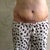 8 days post op