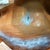 9 days po...My husband didn't get a the best shot. My tummy is all wrinkled, because of the wife beater that