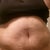 Another 28 day pic. And these are morning pics. We all know swelling is less in the a.m. UG!