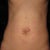 9 DAY POST-OP: Wooot! Are those the beginnings of some upper abs I see?