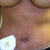 I was a little worried about my belly button but not anymore!!