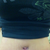 Progress............. I am so happy with my scars. 3 weeks post op
