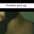 4 weeks post op