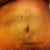 4 Weeks Post OP