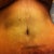 4 Weeks Post Op again!!!