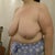 pre op 240 lbs  bra 40gg