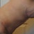 4 weeks post-op