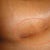Picture of my scar - left side under breast - nearly a year later.