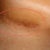 Picture of my scar - right side under breast - nearly a year later.