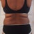Before Back
