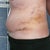 Day 15 PO still very swollen