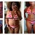 Before, week 1 post op  and 3 weeks post op