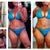 Before, week 1, week 2 and week 3 post op.  Not a huge difference from week 2 to week 3 but the swelling is a bit less this week.