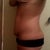 left side before TT