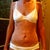 After loosing 100 pounds, but this is before surgery.....saggy yucky skin.