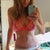 22 Days PO, a little swelling, this pic was taken at the end of the day, and there's some puckering along the incision line, but it will flatten out as time goes on.