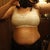 2 weeks, new sports bra. Lots of side swelling
