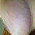 Left side 19 weeks