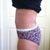 10 weeks left side (note belly button swelling)