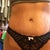 7 months PO. Front view covering scar with panty