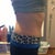 7 months PO. Right side view in yoga pant.