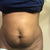 after baby belly